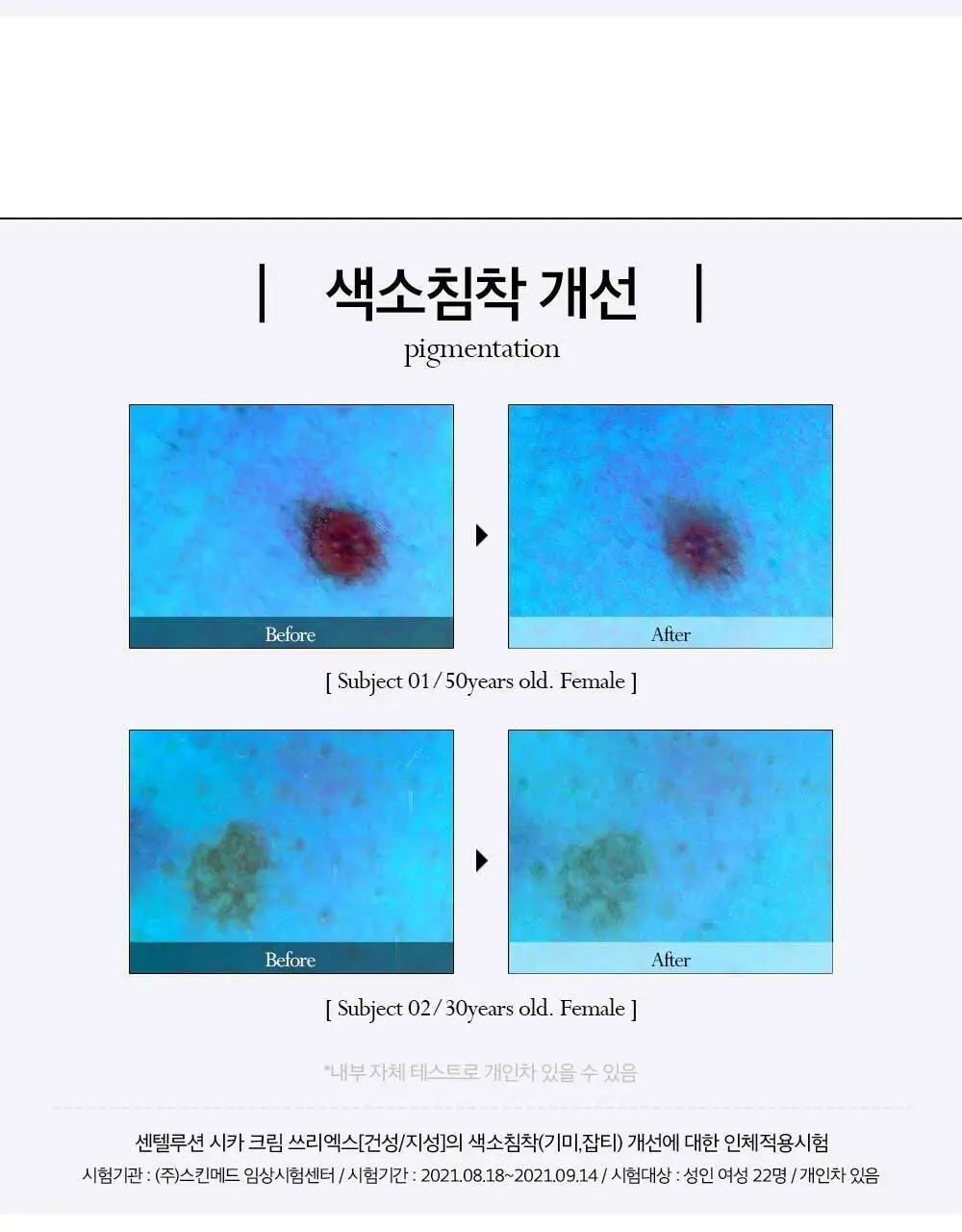 피부미 센텔루션 시카 크림 3X 100ml [건성] 상세페이지 8